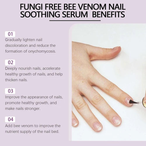 Ximonth Bee Venom Grey Nail Care Solution For Hand And Foot Cleansing Nutrition Repair Brightening Rotten Nails